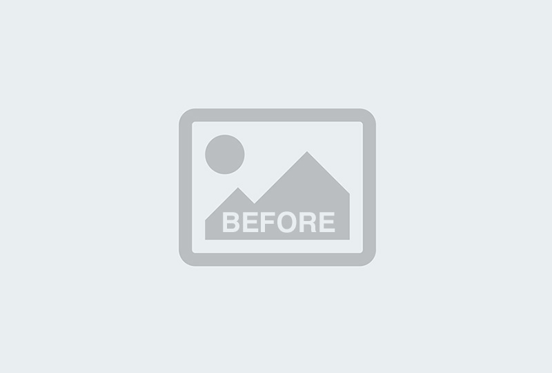 Before Image: Dermaplaning - back