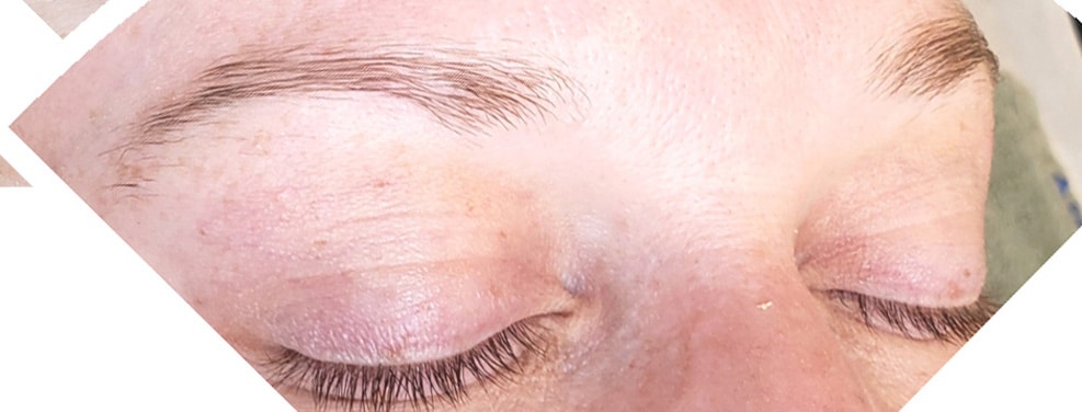 Before Image: Microblading - front