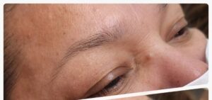 Before Image: Microblading