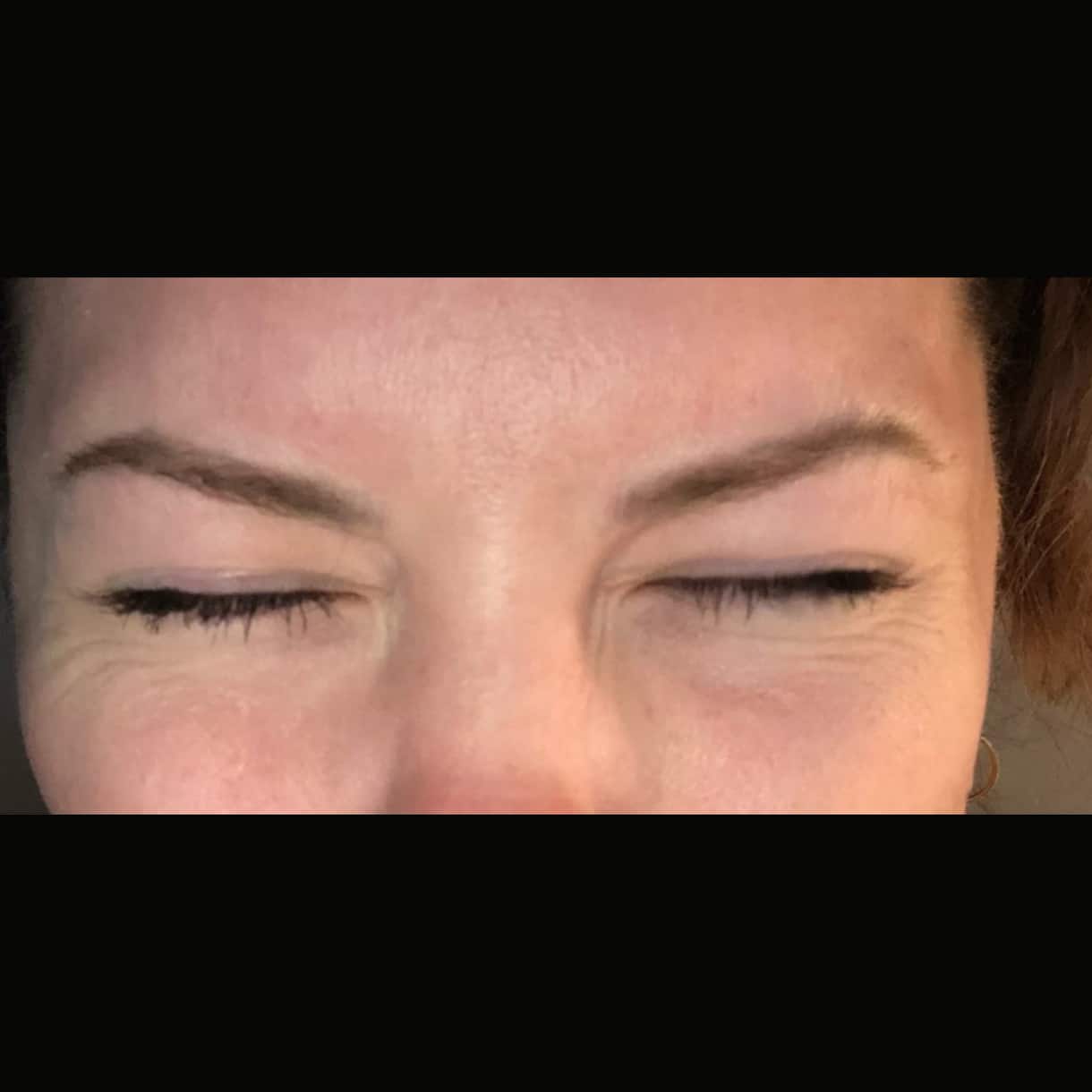After Image: Forehead 11’s - front