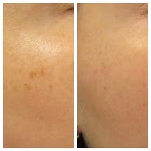 brown-spot-01.jpg